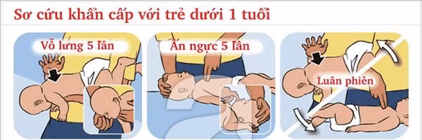 Trẻ tử vong do sặc cháo: Cấp cứu kịp thời có thể cứu mạng trẻ Tre tu vong do sac chao: Cap cuu kip thoi co the cuu mang tre