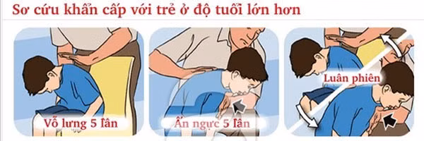 Trẻ tử vong do sặc cháo: Cấp cứu kịp thời có thể cứu mạng trẻ - Hình 2 Tre tu vong do sac chao: Cap cuu kip thoi co the cuu mang tre-Hinh-2