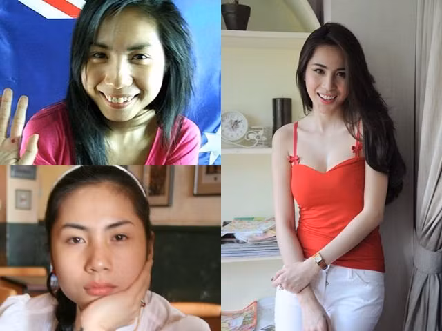 Thế nhưng Thanh Bi không phải là người đầu tiên khi tham gia showbiz bị phát tán những hình ảnh trước khi sử dụng các dịch vụ làm đẹp như nâng mũi, gọt cằm, làm răng ...