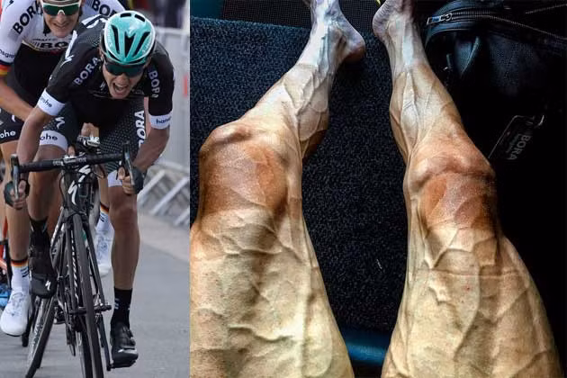 Đôi chân của cua-rơ Paweł Poljański (27 tuổi, người Ba Lan) sau khi hoàn thành 16 chặng của giải Tour de France năm 2017.