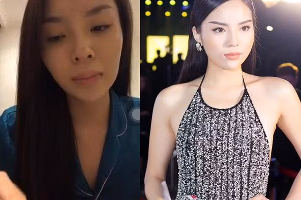 Khi mới đăng quang, Kỳ Duyên vốn sở hữu gương mặt đầy đặn, phúc hậu với các đường nét khá tròn trịa. Tuy nhiên theo thời gian hoạt động trong showbiz, khuôn mặt đặc biệt là phần cằm của cô càng ngày càng khác biệt. Nhan sắc "khi trồi, khi sụt" của chân dì 9X này khiến nhiều fan ngạc nhiên, tiếc nuối. Chia sẻ về chiếc cằm bất thường của mình, Kỳ Duyên từng cho biết cô không phẫu thuật thẩm mỹ mà chỉ bấm huyệt, mát xa để mặt gọn hơn.