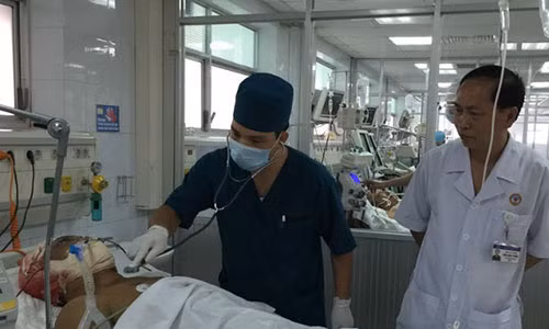 4 cơn đau đầu tử thần không được chủ quan kẻo hối hận 4 con dau dau tu than khong duoc chu quan keo hoi han