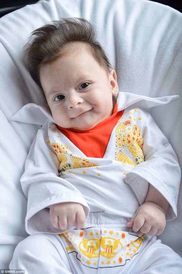 Cậu bé George Georgious ở London. Anh vừa đẻ ra đã có bộ tóc sành điệu như ca sĩ huyền thoại Elvis Presley. Đặc biệt, dù dùng rất nhiều cách để vuốt xuống, bộ tóc kỳ lạ của cậu bé George vẫn giữ nguyên hình dạng. Nguyên nhân được cho là do mẹ của George, cô Maria mắc phải bệnh tiêu hóa khi mang thai cậu bé. Theo khoa học, phụ nữ mắc bệnh tiêu hóa sẽ sinh con có nhiều tóc hơn thông thường.