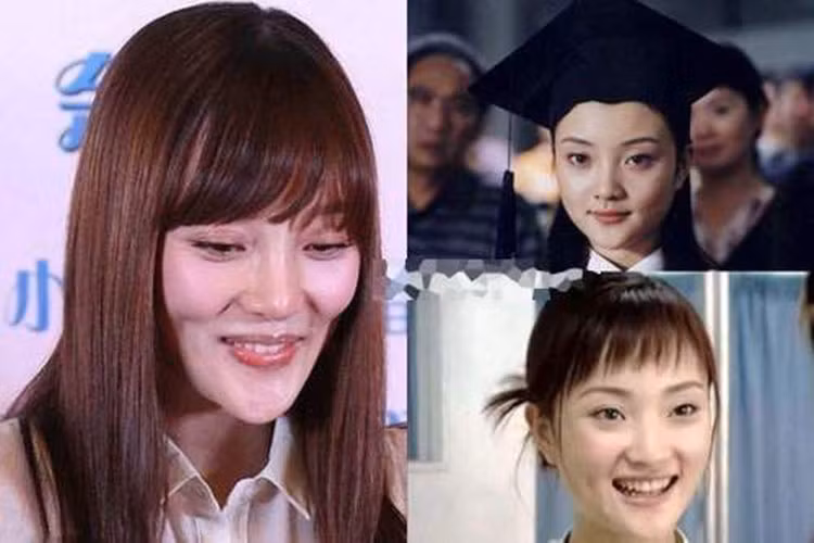 Lý Tiểu Lộ từng bị gắn mác thảm họa phẫu thuật thẩm mỹ. Ảnh: Sina