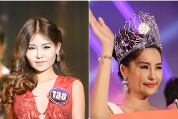 Ngân Anh khẳng định gương mặt của cô hiện tại hoàn toàn tự nhiên. Tuy nhiên, lời giải thích này không làm hài lòng số đông cư dân mạng. Ảnh: Dân Việt