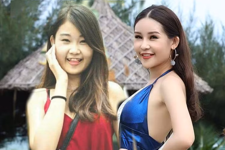 Ngân Anh bị chê sở hữu nhan sắc chưa xứng tầm hoa hậu. Ngoài ra, sau loạt ảnh quá khứ của Ngân Anh, không ít dân mạng đặt nghi vấn cô đã dao kéo. Ảnh: Zing