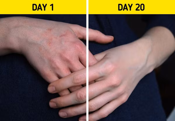 Vitamin B3 còn được ví như hàng rào bảo vệ da, duy trì độ ẩm cực nhạy. So với việc sử dụng các loại kem bôi ngoài da có kết quả sau vài tuần, vitamin B3 sẽ mang lại hiệu quả trong thời gian rất ngắn. Ảnh: BS, Internet.