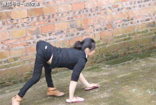 Dù vậy, một điểm khiến giới nghiên cứu băn khoăn là ngay cả những đứa trẻ sinh ra khỏe mạnh cũng có tư thế di chuyển này.