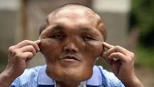 Kỳ dị ông lão có khuôn mặt của người ngoài hành tinh Ky di ong lao co khuon mat cua nguoi ngoai hanh tinh