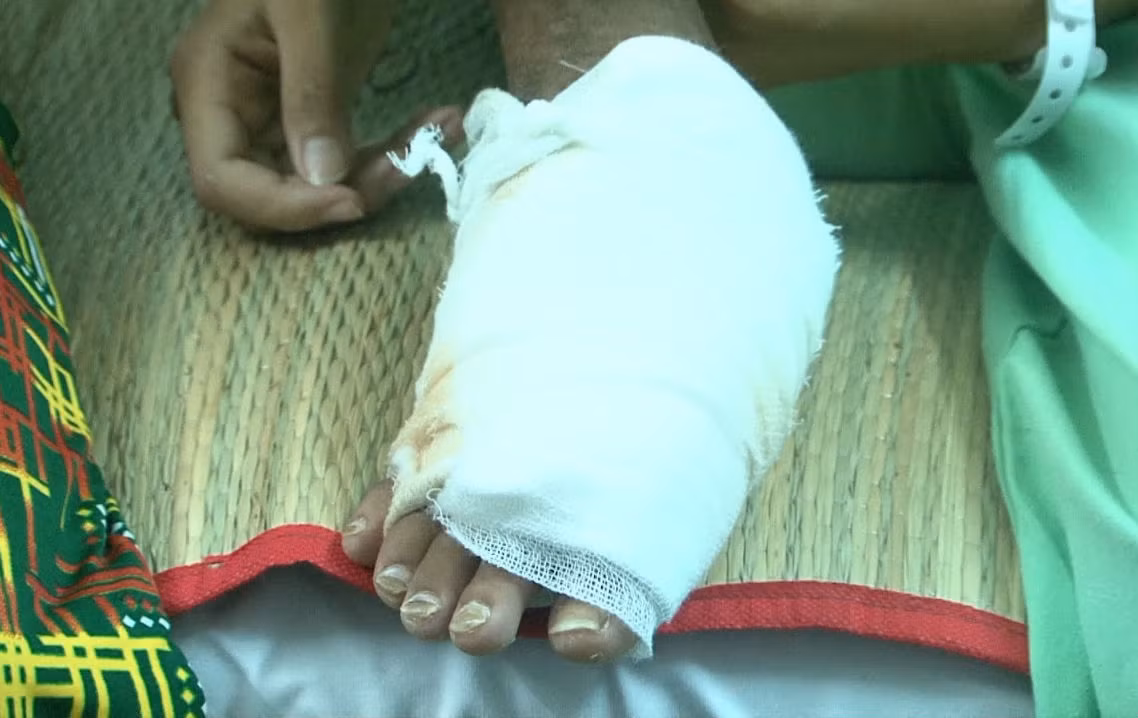 Bé gái phải trải qua ít nhất 2 cuộc phẫu thuật.