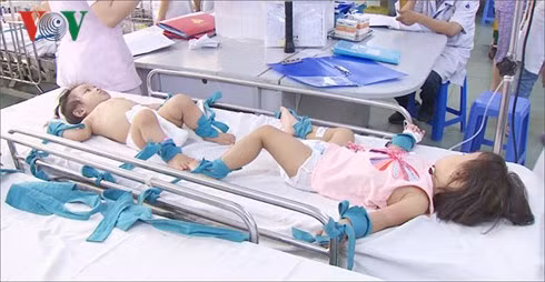 Bệnh tay chân miệng tăng đột biến, lo ngại bùng phát ở TP HCM - Hình 2 Benh tay chan mieng tang dot bien, lo ngai bung phat o TP HCM-Hinh-2