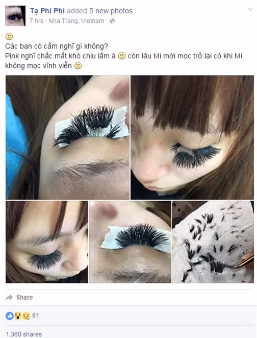 Hàng lông mi sau khi được nối trông có khác gì cái chổi? Không chỉ chọn loại mi cứng ngắc nhìn rất giả, "tác giả" của hàng mi này còn chấm keo dày, ẩu tạo ra những cục vón bết trên hàng mi thật của khách hàng.