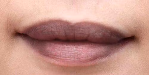 Môi thâm khiến ngoại hình chị em trở nên xấu đi vài phần.