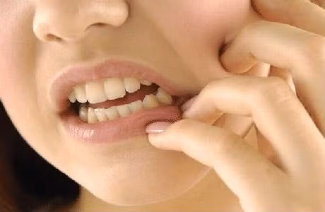 Bai thuoc chua sau rang tu la lot cuc nhanh