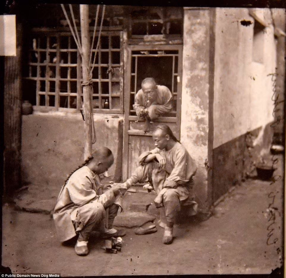 Một thầy thuốc kiểm tra bệnh tình ở chân của bệnh nhân tại Bắc Kinh năm 1869.