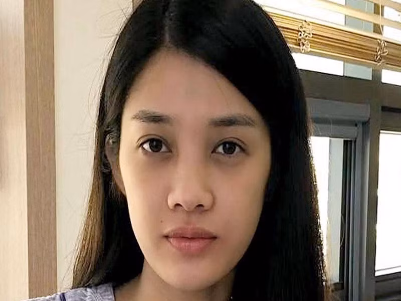 Mới đây, Trình Mỹ Duyên chia sẻ loạt ảnh “đập đi làm lại” gương mặt. Trong ảnh, nữ diễn viên trước khi phẫu thuật thẩm mỹ.