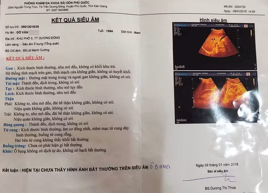 Kết quả siêu âm của anh Đ.
