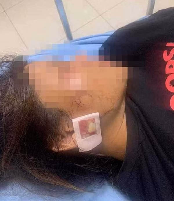  Công an vào cuộc vụ nổ súng do va chạm giao thông: Mới đây, Công an huyện Hậu Lộc, tỉnh Thanh Hóa đang vào cuộc điều tra vụ nổ súng xảy ra vào đêm 2/8 tại xã Hòa Lộc. Trước đó, vào tối ngày 2/8, anh H. (SN 1977) và anh M. đều trú xã Hoà Lộc, huyện Hậu Lộc, tỉnh Thanh Hóa đang đi trên đường thì xảy ra mâu thuẫn. Trong lúc xô xát thì bất ngờ có tiếng súng nổ vang lên. Thời điểm này vợ anh M. bị thương. Hiện cơ quan chức năng đang điều tra nguyên nhân vụ việc. 