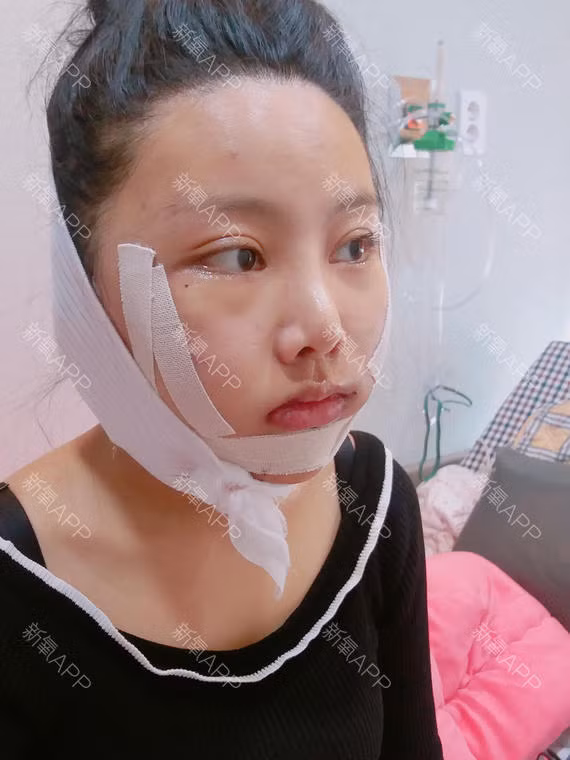 30 ngay bien hoa cua co nang phau thuat tham my-Hinh-8