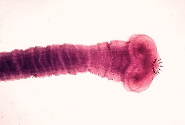 Taenia solium, còn được gọi là sán dải heo hay sán dải lợn. Đây là loài ký sinh trong cơ thể heo và con người. Khi theo máu đi vào não, sán dải heo phát triển, có thể khiến bệnh nhân tử vong nhanh chóng.