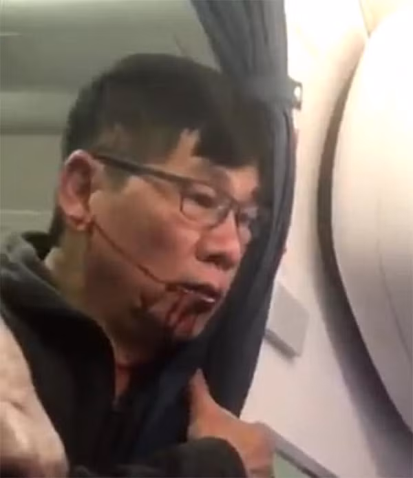 Ong David Dao duoc boi thuong bao nhieu neu thang kien United Airlines?