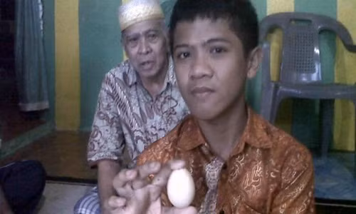 Cha của Akmal nói rằng cậu bé đã đẻ 20 quả trứng trong suốt 2 năm qua.