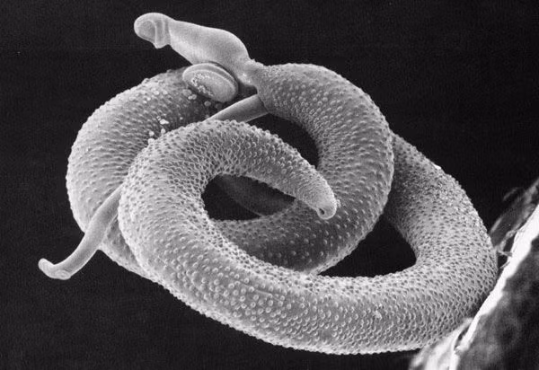 10. Giun ký sinh Schistosoma mansoni, mặc dù hiếm người biết nhưng loài giun ký sinh này hình thành liên kết đôi một vợ một chồng trong suốt thời gian sinh sản hữu tính trong cơ thể người. Chu kỳ sống của chúng kéo dài bao nhiêu lâu thì sự chung thủy của chúng kéo dài bấy lâu. Nghe thì có vẻ lãng mạn nhưng loài giun này gây ra bệnh sán máng, một căn bệnh vô cùng khó chịu.