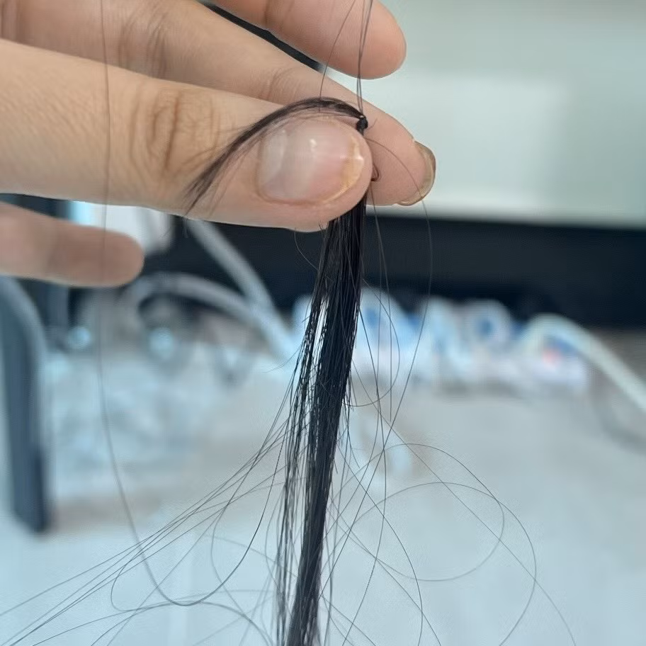 Cô chia sẻ: "Da t bị rạn do tăng cân đột ngột mọi người ạ. Trị rạn da chích kim đau thấu trời xanh. Tóc t thì bị rụng, sợ hãi quá ai gặp cũng xót. Nên phải cắt ngắn đi cho nó mọc lại".