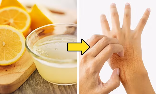 5. Ngâm tay với hỗn hợp dầu ẩm nước chanh: Cách này được cho là kích thích sự phát triển của móng tay nhưng sẽ ảnh hưởng đến làn da của bạn.