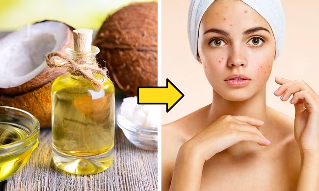 7. Sử dụng các loại dầu: Nhiều bạn sử dụng dầu thay cho kem nhưng có thể gây ra dị ứng và nên nên sử dụng hạn chế.
