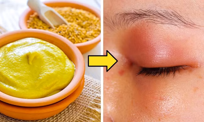 3. Sử dụng mặt nạ hỗn hợp: Với nhiều thành phần khác nhau tạo thành mặt nạ tuy nhiên có thể gây ra các vấn đề như: bỏng, đỏ, dị ứng da và nổi mày đay.