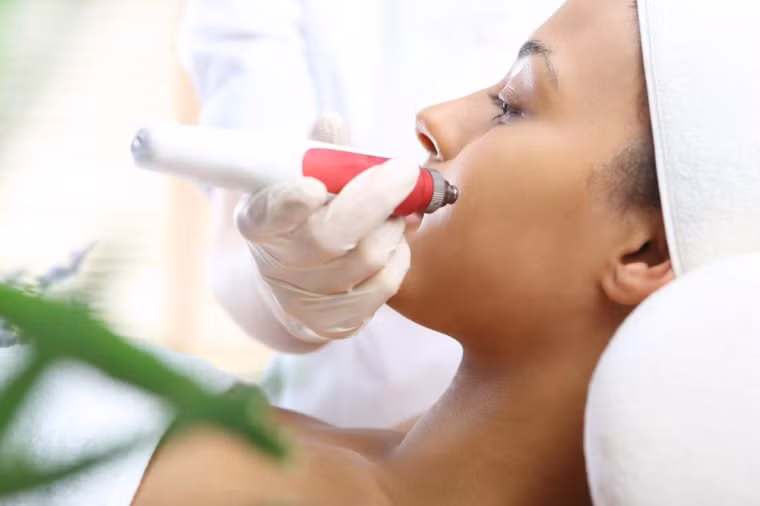 Hiệu ứng làm mịn da: Sự kết hợp các phương pháp điều trị với vi kim và plasma sẽ làm cho da bạn thêm mịn màng và tự nhiên hơn.