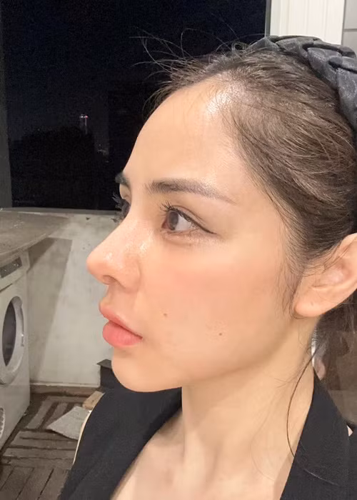 Bạn gái Huỳnh Anh chia sẻ: "Người ta phải mất tiền nâng lên, còn mình đi hạ thấp xuống. Nhưng thôi cho giữ được của vậy các bác ạ chứ em nghèo quá".