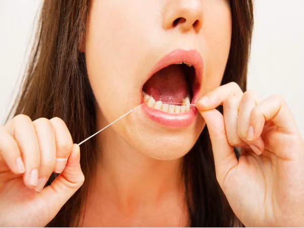 Dùng chỉ nha khoa. Vài hãng sản xuất cho chất chống dính lên chỉ nha khoa để giúp chúng di chuyển dễ dàng hơn giữa các kẽ răng. Những hóa chất này có thể gây bệnh về tuyến giáp. Ảnh: Boldsky