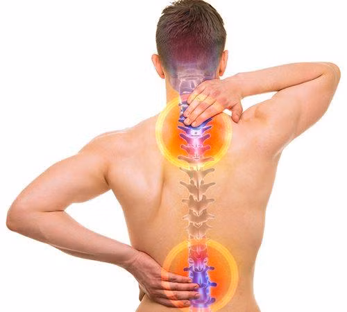 Món ăn 'thần dược' cho người bị thoái hóa cột sống Mon an 'than duoc' cho nguoi bi thoai hoa cot song
