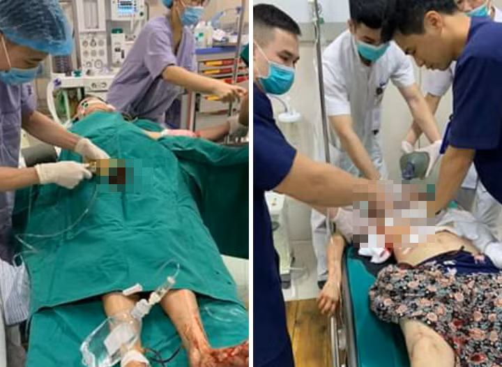 Chong cam dao truy sat ca nha vo roi tu tu