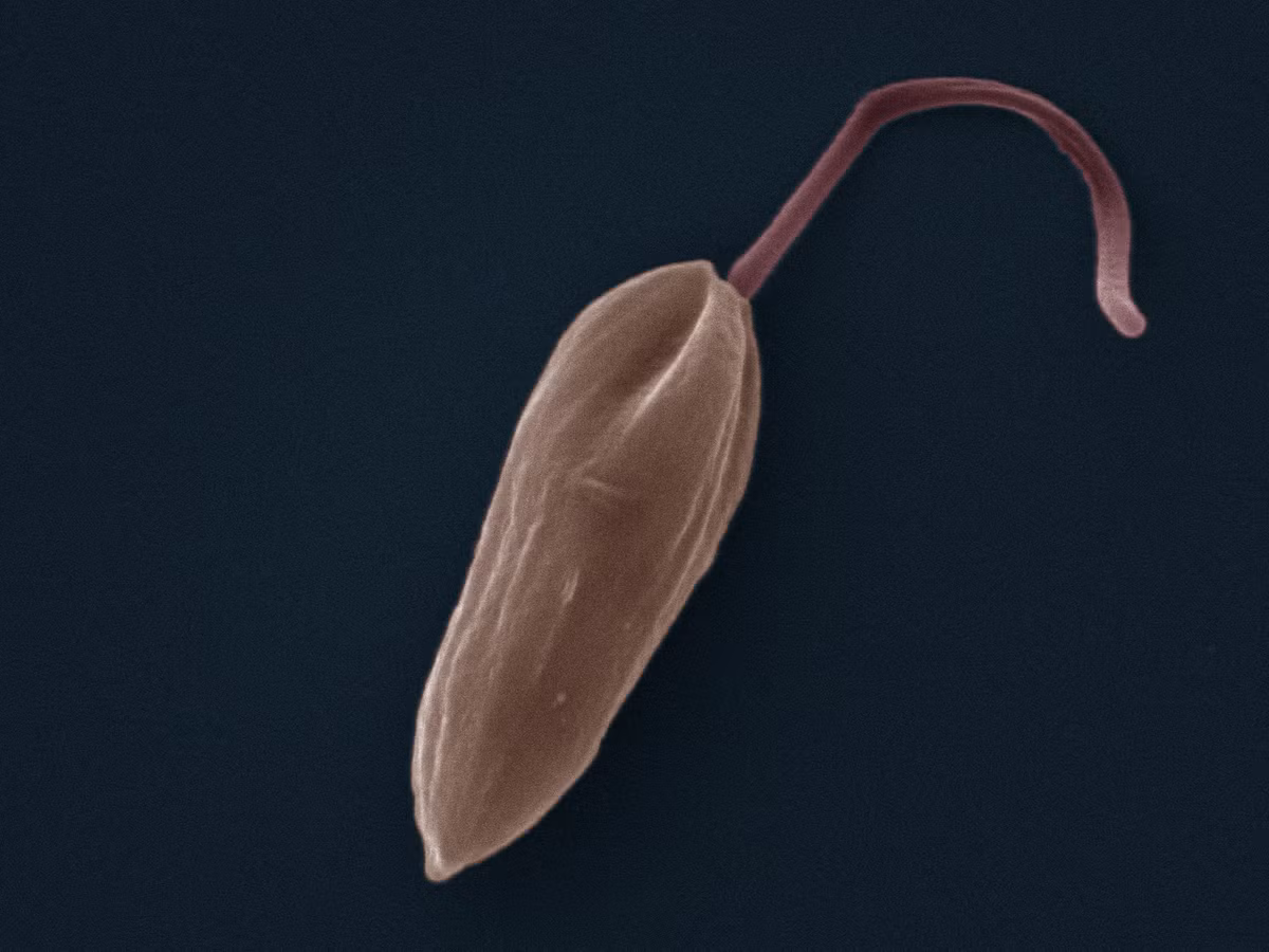 Leishmaniasis là bệnh gây ra bởi sinh vật đơn bào Leishmania ký sinh ở đường máu và hệ lưới mô bào. Leishmania lây lan qua những vết cắn của ruồi cát vào những vết thương hở, nhiễm trùng.
