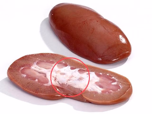 8 món khoái khẩu từ thịt lợn cần tránh nếu không muốn rước bệnh - Hình 6 8 mon khoai khau tu thit lon can tranh neu khong muon ruoc benh-Hinh-6