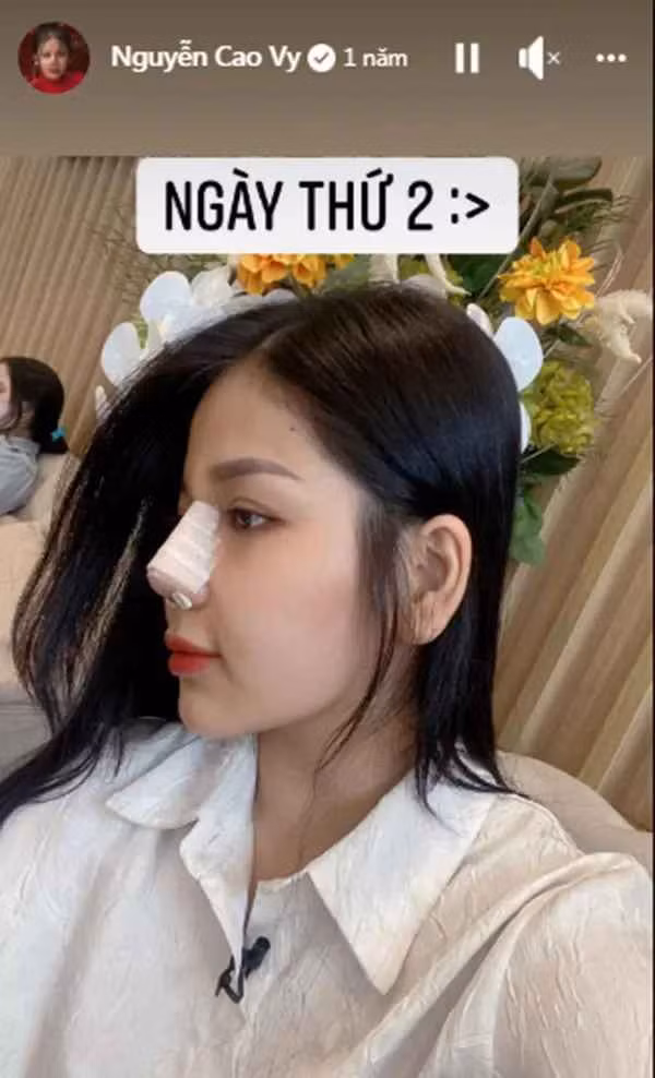Đặc biệt nhất, nhan sắc của Cao Vy có sự thay đổi rõ rệt. Theo đó, cô đã thực hiện phẫu thuật nâng mũi để cho gương mặt thanh thoát hơn.