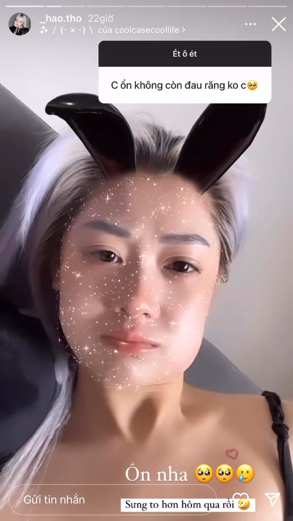 Cụ thể là sau vài ngày bị răng khôn hành cho đau âm ĩ, thì nữ streamer này quyết định tìm đến nha khoa để xử lý.