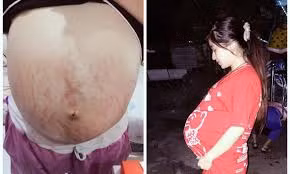 Bên cạnh đó, nhiều chị em còn học hỏi kinh nghiệm, chỉ nhau những mẹo giúp làn da đẹp hơn khi mang bầu. Nhiều người cũng nhận định, là phụ nữ thì khi mang bầu cũng phải đẹp.