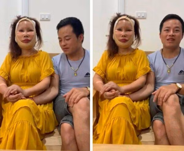 Việc ở tuổi ngoài U60 vẫn còn mạo hiểm phẫu thuật của cô Thu Sao khiến nhiều người để lại bình luận lo lắng cho sức khỏe của cô. Đa phần đều khuyên cô dâu 62 tuổi này rằng giữ chồng có nhiều cách, không nhất thiết phải làm quá nhiều thủ thuật thẩm mỹ.