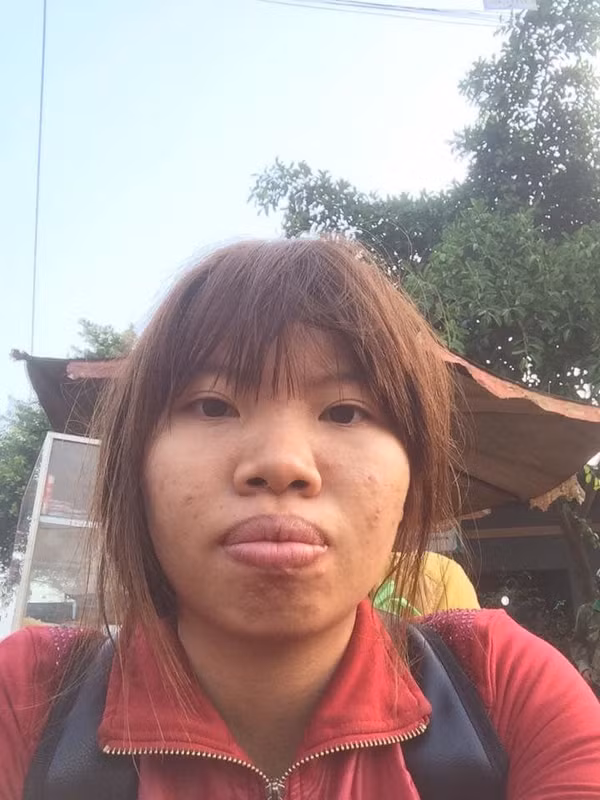 Nói đến những pha đổi đời nhờ "tân trang" thì nhất định không thể thiếu cái tên Quách Phượng (biệt danh Phượng Thị Nở, SN 1996). Cô nàng từng phải đối mặt với khoảng thời gian tự ti về ngoại hình, thậm chí "lỡ một lần đò" chỉ vì sở hữu ngoại hình kém lung linh.