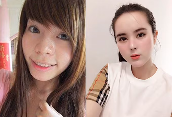 Không ít trường hợp từng đẹp lên "vài phần" nhờ phẫu thuật thẩm mỹ.