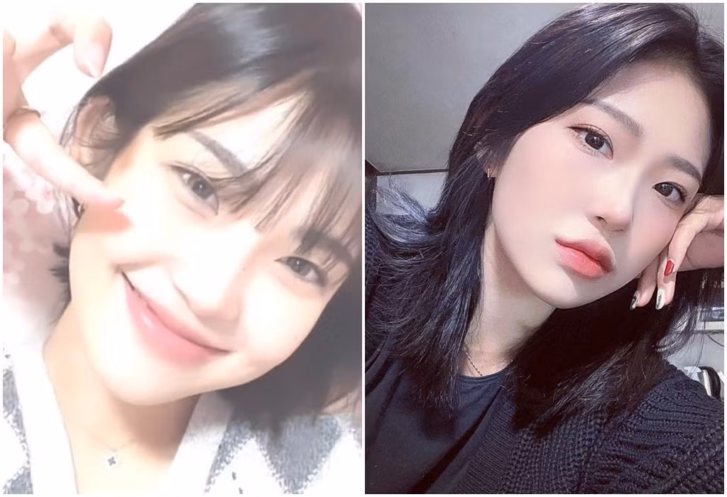 Gương mặt ăn điểm của hot girl Hàn Quốc sau khi giảm cân và 2 lần động "dao kéo".