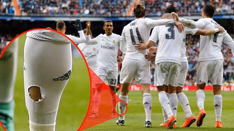 Bale khi từng thi đấu cho Real Madrid cũng đã từng đi tất rách.