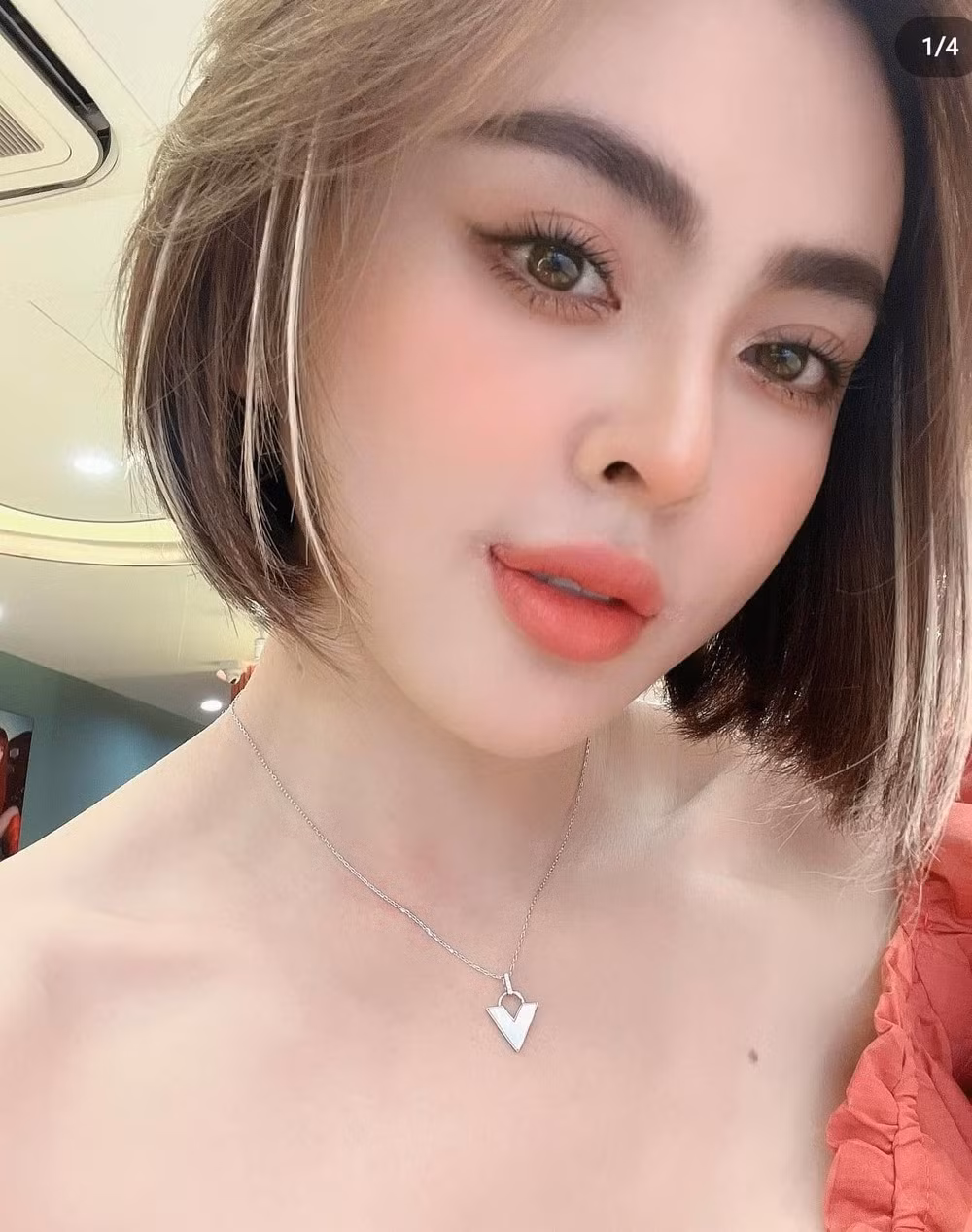 Thậm chí có lần Trang Nemo còn không ngại đăng ảnh khuôn miệng sau tiểu phẫu lên trang cá nhân.