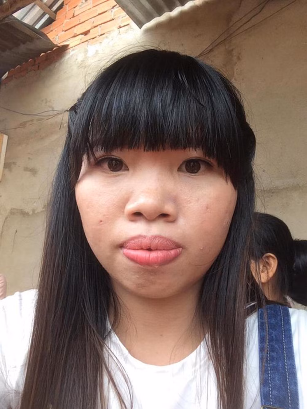 Loạt hình ảnh với gương mặt thô kệch, răng hô, da đen đúa, chi chít mụn của Quách Thị Kim Phượng được chia sẻ lúc đó đã thu hút sự chú ý của rất nhiều người.