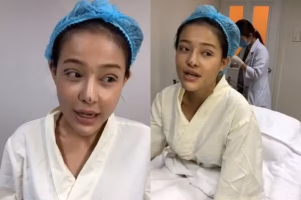 Sắp tới, Ngân 98 sẽ phải tháo mũi giả, điều trị dứt điểm để hết tình trạng viêm rồi 3-4 tháng sau mới được thẩm mỹ trở lại.
