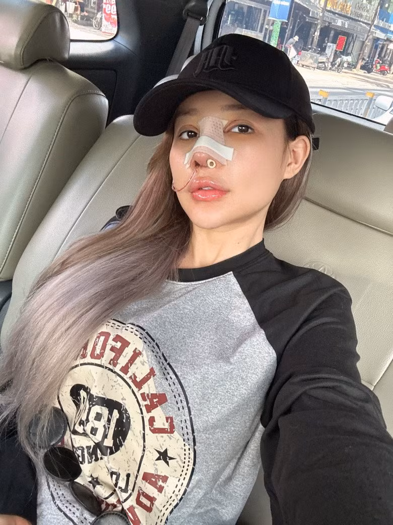 Ngân 98 dự định sẽ "dao kéo" lại chiếc mũi đã qua chỉnh sửa của mình trong tháng 11 sắp tới.